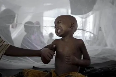 Vəba epidemiyası: - Ölənlərin sayı 315-ə yüksəldi