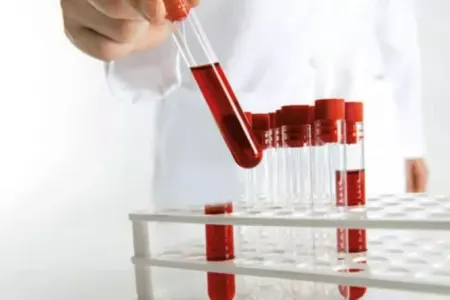 Bu qan qrupuna sahibsinizsə, uzun yaşayacaqsınız