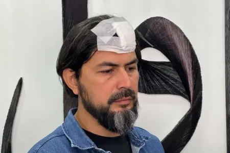 Müəllimə hücum edildi