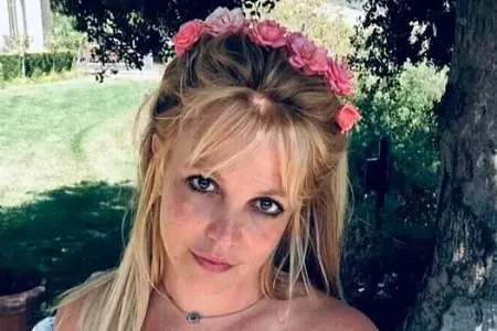 Britninin üzü yandı