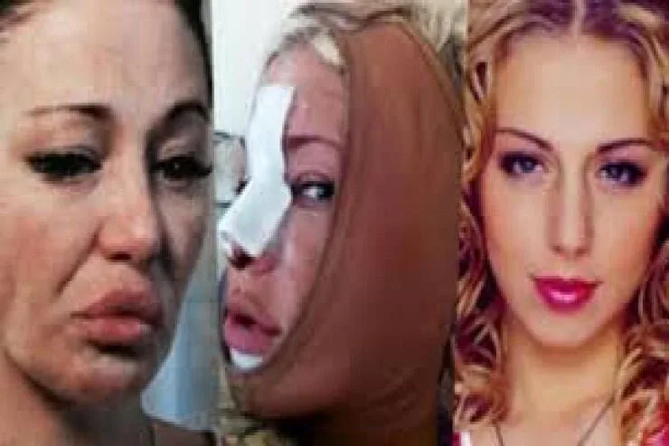 Məşhur müğənni komaya düşdü - FOTO