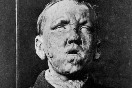 Keçmişdən bu günə mövcud olan dəhşətlər