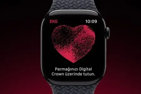 "Apple Watch" yaşlı qadının həyatını - BELƏ XİLAS ETDİ