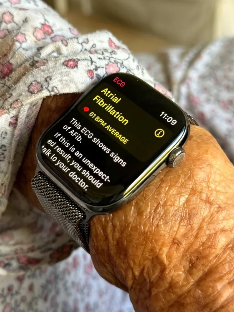 "Apple Watch" yaşlı qadının həyatını - BELƏ XİLAS ETDİ