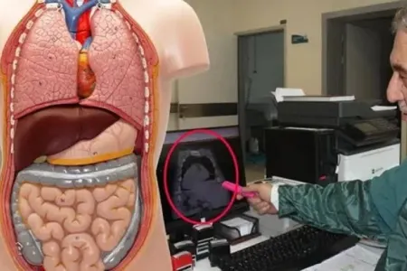 Bütün orqanları yerini dəyişdirdi: - Dünyada ilk dəfə ...