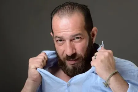 Kamran Ağabalayev tanınmaz halda - FOTO