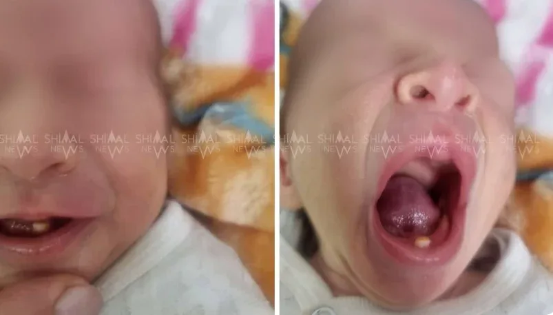 Qubada yeni doğulmuş körpə hamını təəccübləndirdi - – FOTO