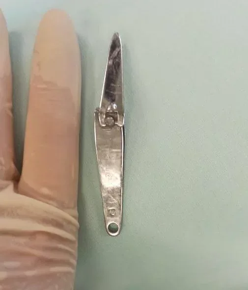 6 yaşlı uşaq elə bir şey uddu ki... - FOTOLAR
