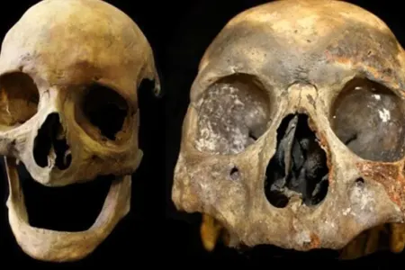 Təsiri ölümdən sonra da davam edir: - Siqaretin qalıcı fəsadları