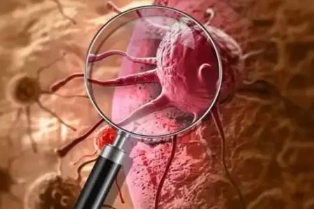 Yeni kəşf: Xərçəng hüceyrələrini öldürən bakteriyalar tapıldı