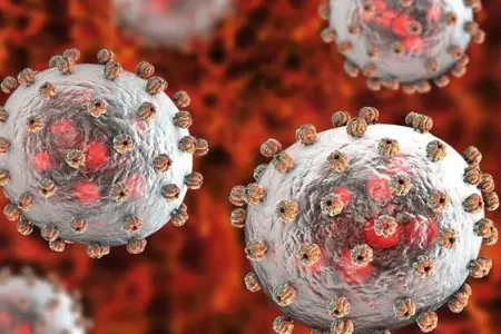 Lassa qızdırmasından 21 nəfər - ÖLDÜ - Bu ölkədə