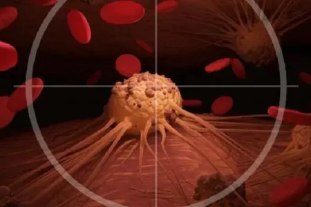 Tibbdə İNQİLAB: xərçəngi məhv etməyin sadə yolu tapıldı