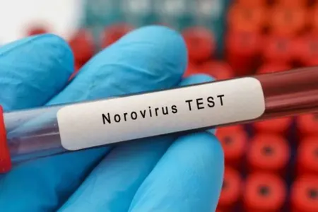 Norovirus peyvəndi üçün ilk sınaqlar BAŞLADI