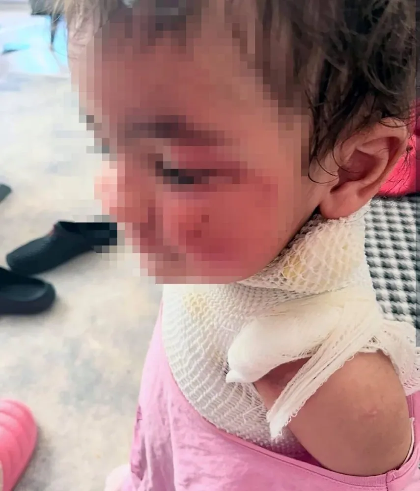 Uşaq bağçasında körpənin üzərinə qəhvə töküldü - Ailə İNANMADI... - foto