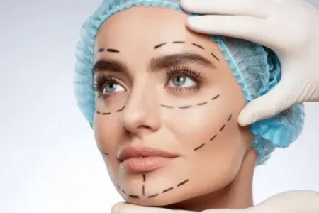 Plastik əməliyyatların yaratdığı daha bir problem