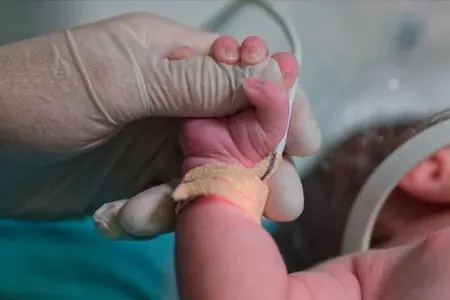 Keysəriyyə ilə doğuşların ümumi xüsusiyyəti: - İlk baxışdan fərq edilə bilər