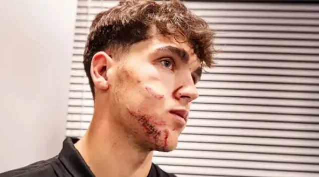 Məşhur futbolçunun sifətini dağıtdılar - 10 tikiş qoyuldu - Foto