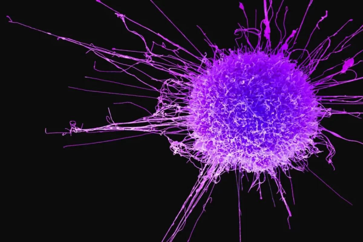 Bədəninizdə bu əlamətlər varsa... - Diqqət!