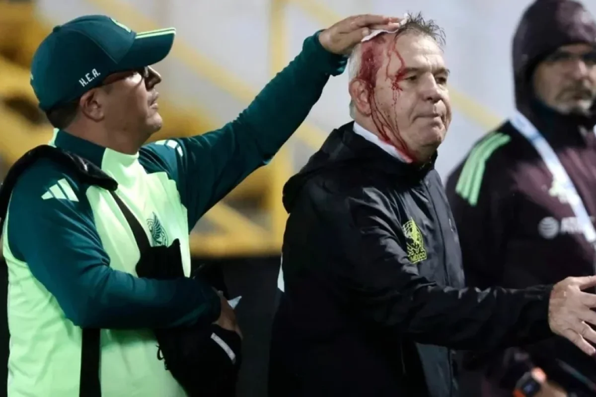 Millinin baş məşqçisinin başını yardılar