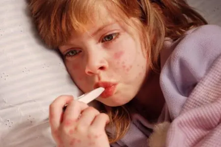 Virusların artdığı DÖVR - "Laborator analizlərə ehtiyac var"