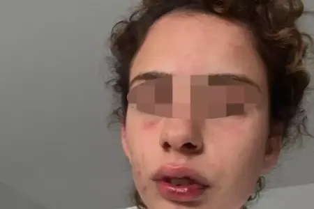 24 yaşlı gənc ondan ayrılmaq istəyən sevgilisinə səhərə qədər işgəncə verdi – FOTOLAR