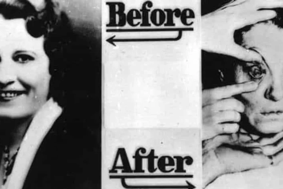 Bu məhsula görə qadınlar gözlərini itirirdilər: - 30-cu illərin gözəllik fəlakəti