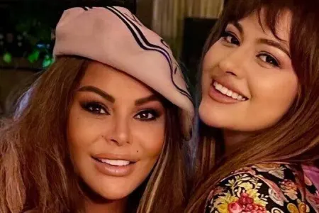 Aygün Kazımovanın qızı dodaqlarını şişirtdi, tanımaq olmadı