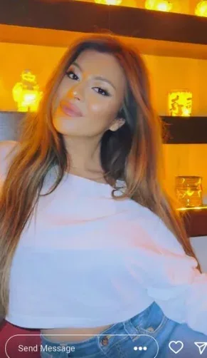 Aygün Kazımovanın qızı dodaqlarını şişirtdi, tanımaq olmadı