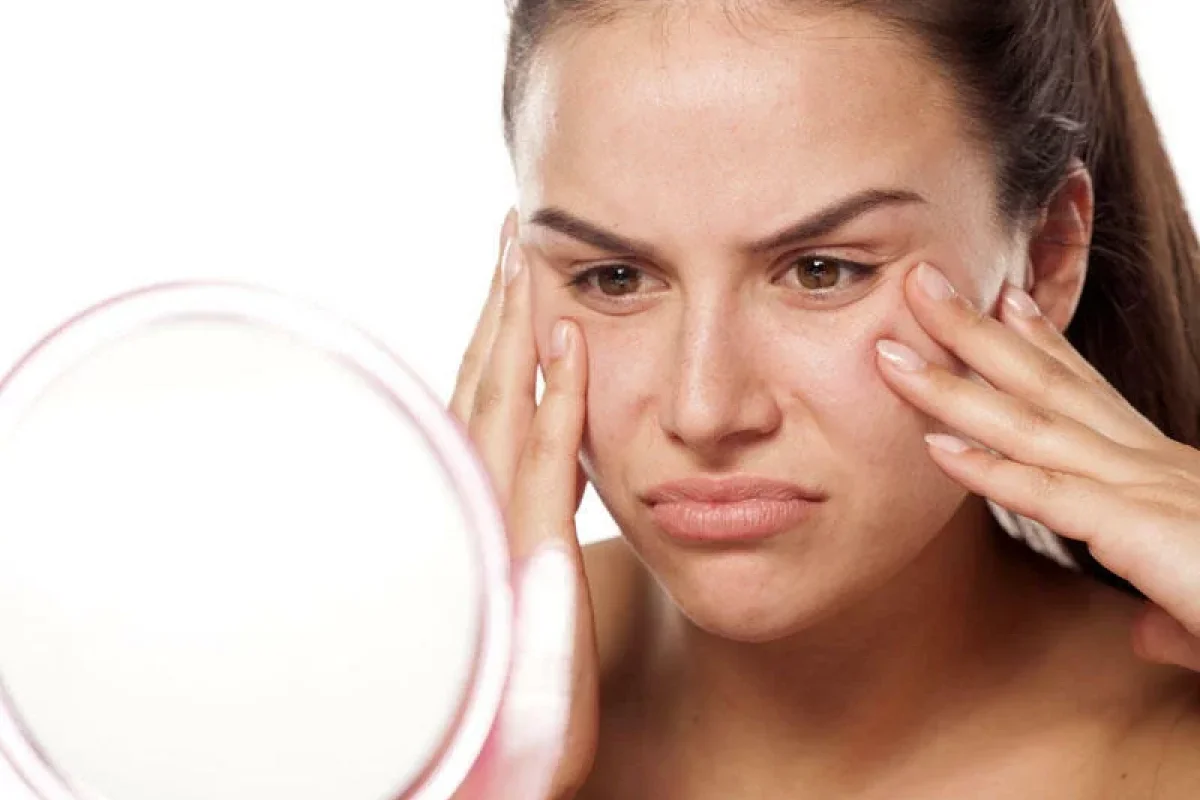 Üzdəki ləkələrdən necə qurtulmaq olar?