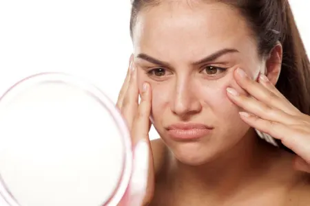 Üzdəki ləkələrdən necə qurtulmaq olar?