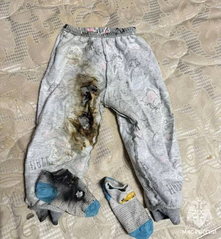 Dəhşət yaşandı! 9 aylıq körpə..