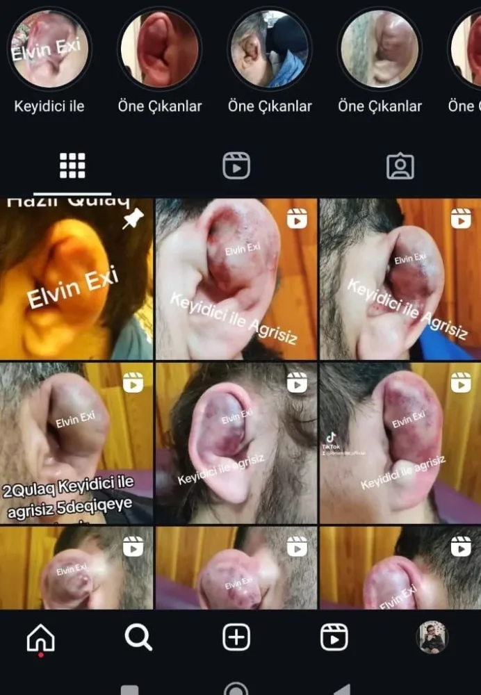 Bakıda pullu qulaqsındırma xidməti - QİYMƏTLƏR