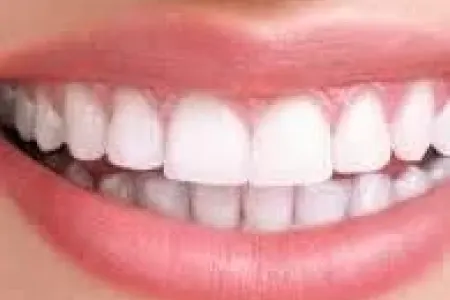 Dişlər niyə tündləşir? - Həkim səbəblərdən DANIŞDI