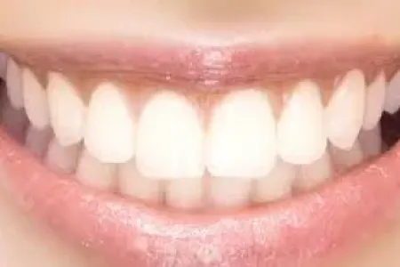 Həkim səhvi ucbatından 16 dişi itirdi