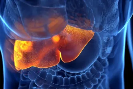 Qaraciyəri xəstə olanlara ŞAD XƏBƏR: - Həkim elə fakt aşkarladı ki...