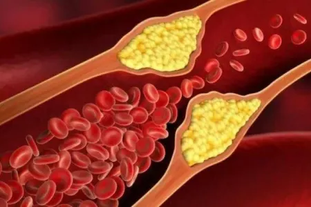 Qanda xolesterini azaldan ən faydalı 3 məhsul