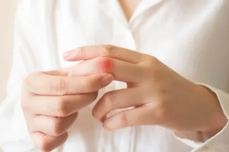 Əllərdə bu simptomlar xərçəngin - ən təhlükəli növündən xəbər verə bilər