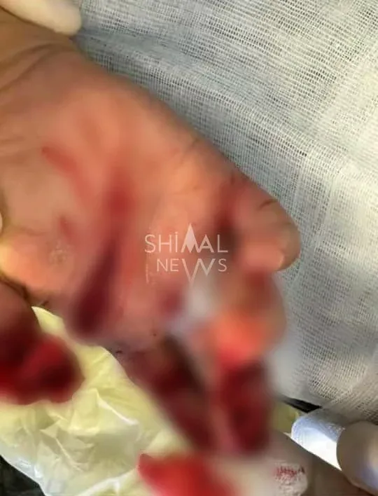 Sahibsiz itlər sakinləri qapdılar - HƏSSAS GÖRÜNTÜLƏR