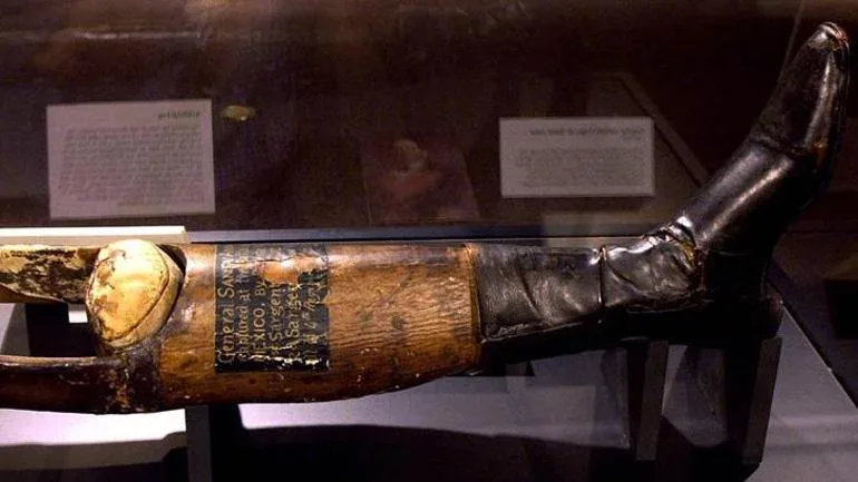 Kəsilən ayağını məzardan çıxaran GENERAL!