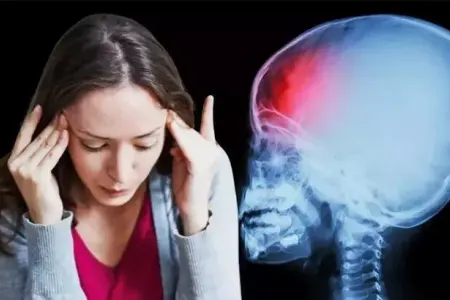 Baş ağrılarını həkimə getmədən sağaltmanın yolları