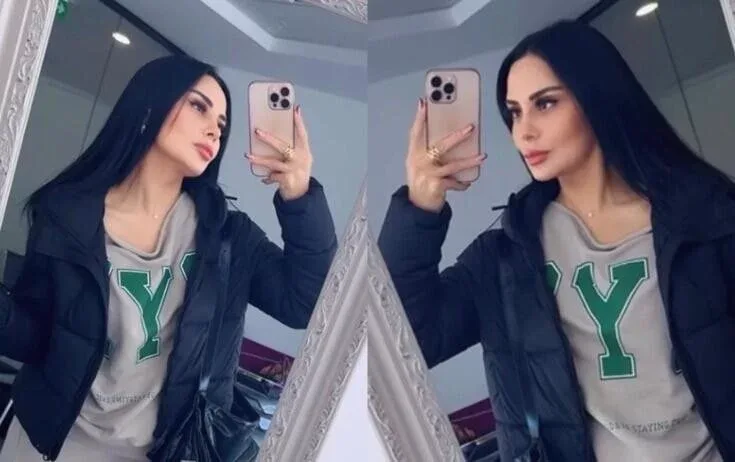 Vüsalənin üzünə nə olub? - FOTO