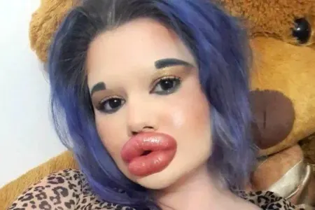 Dünyada ən böyük dodaqları olan qadın makiyajsız belə görünür - FOTO