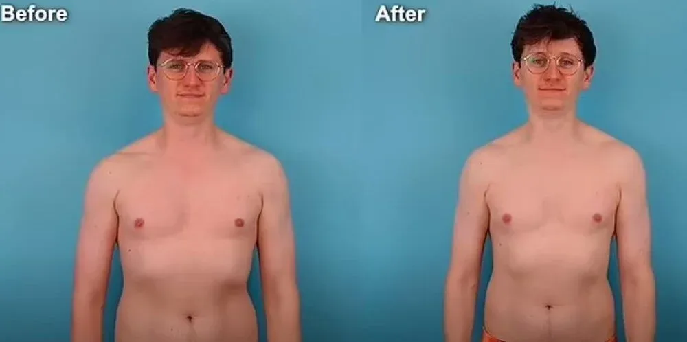 Həftədə 250 min addım atdı: - Bədənindəki dəyişiklik onu ŞOKA SALDI