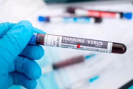 Təhlükəli virus yayılır - Ölənlər var