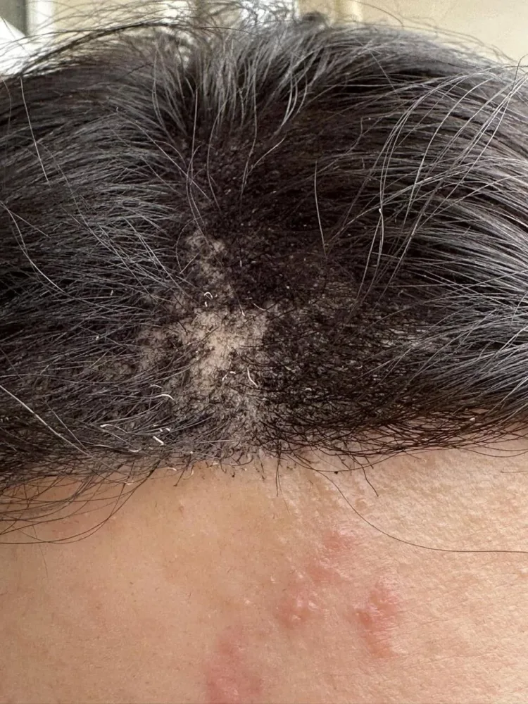 Məşhur salonda lazeroloq qadının saçın yandırıb, - günahkar çıxartdı