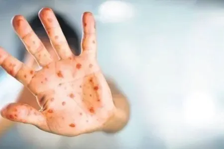 Daha bir QORXULU VİRUS qapıda! - diqqətli olmaq lazımdır, çünki...