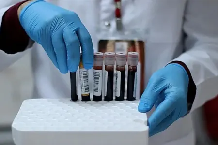 Dünyada yalnız 43 insanda olan - QIZIL QAN QRUPU