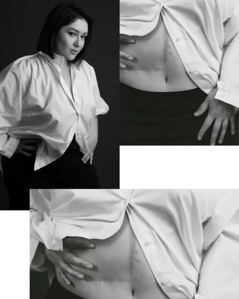 Nərmin Kərimbəyova qarnını göstərdi - FOTOLAR