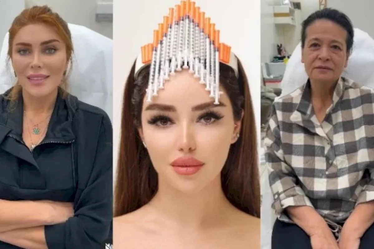 Nazirliyin əməkdaşları ilə qalmaqal yaşayan kosmetoloqun məşhur pasiyentləri - SİYAHIDA KİMLƏR VAR?