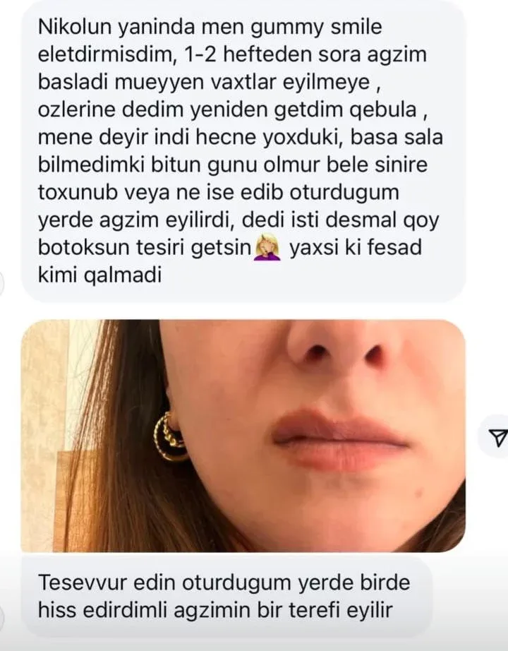 Məmurlara telefon çırpan Rəna Soltanovadan - ŞOK şikayətlər – FOTOFAKT